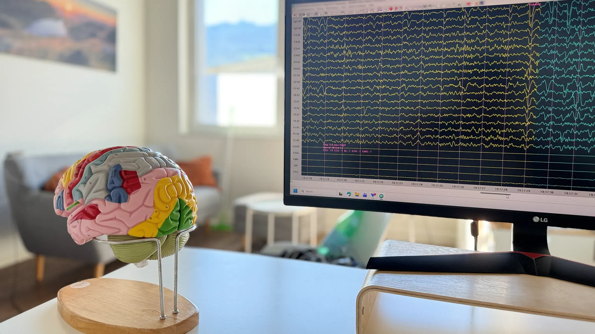 Farbiges Hirnmodell auf dem Tisch im Praxisraum von BRAINLI, daneben ein Bildschirm mit EEG-Kurven